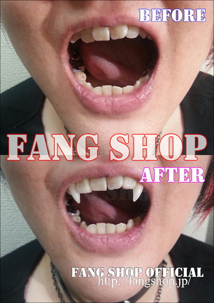 FANG SHOP 付け牙 A-0278(左右側切歯審美Type)